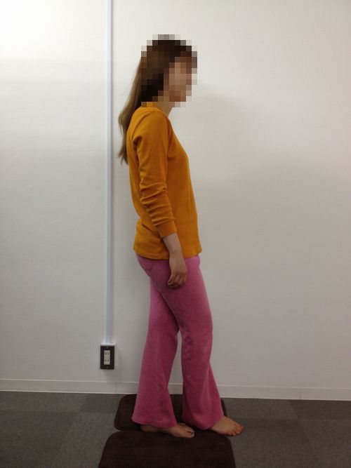 股関節のねじれ矯正事例