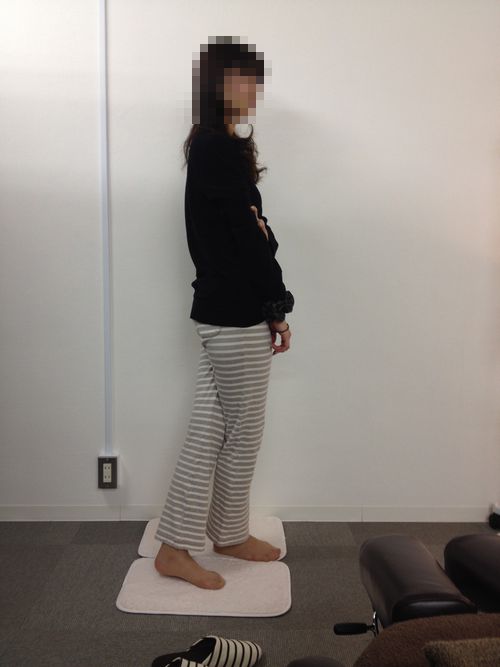 内股の矯正事例