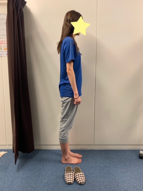 姿勢が良ければモデルさん級なのにもったいない！｜コラム｜姿勢矯正専門整体院mint